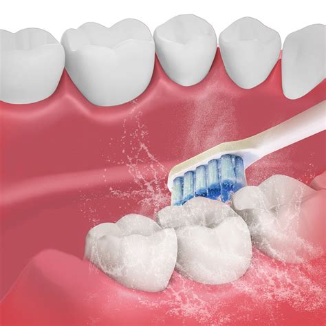 CARA MERAWAT GIGI AGAR SEHAT - AGM MEDICA