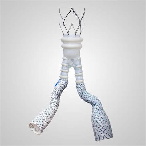 Deborah Now Offering Alto® Abdominal Stent Graft System To Patients To