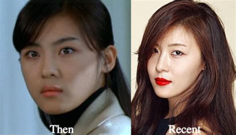 Ha Ji Won Plastic Surgery Before And After Photos Latest Plastic