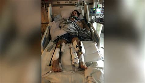 Citrus Heights Woman Recovers In Hospital After Suspected Dui Crash Shatters Her Legs Fox40