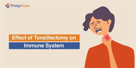Effect Of Tonsillectomy On Immune System Pristyn Care