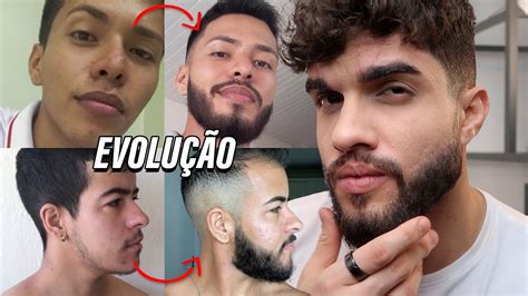 Evolução Minoxidil Dos Inscritos Barba Antes E Depois 🧔 Youtube