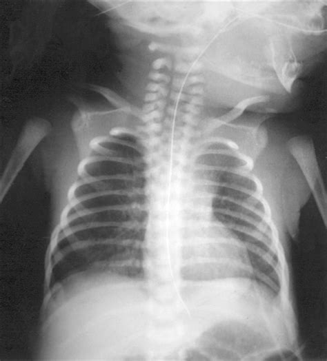 Radiological Case Of The Month Pediatrics Jama Pediatrics The Jama Network