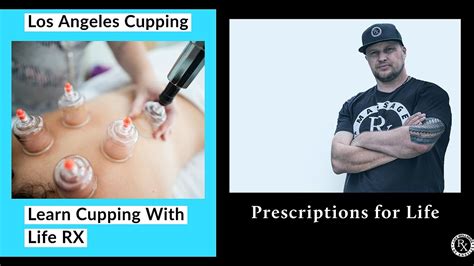 cupping therapy fire cupping life rx los angeles youtube
