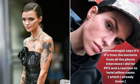 Ruby Rose Shares Makeup Free Photos Of Her Acne Daily Mail Online