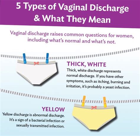 Vaginal Discharge What S Normal And When Should You Call Sexiz Pix