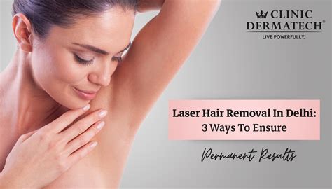 Top 48 Image Laser Hair Removal Permanent Vn