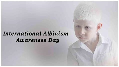International Albinism Awareness Day 13 June আন্তর্জাতিক অ্যালবিনিজম