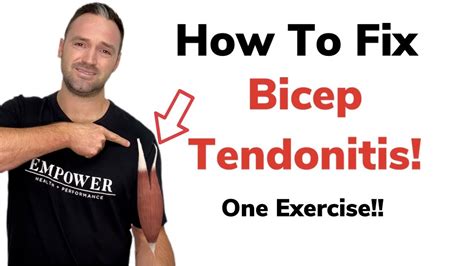 How To Fix Bicep Tendonitis Youtube