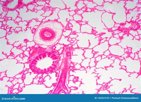 Human Lung Tissue Under Microscope View Stock Photo Image Of Organ