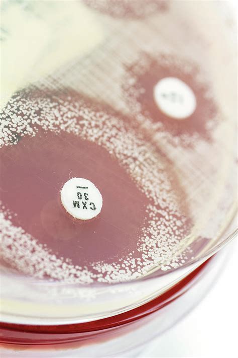 Staphylococcus Culture And Antibiotics Photograph By Daniela Beckmann