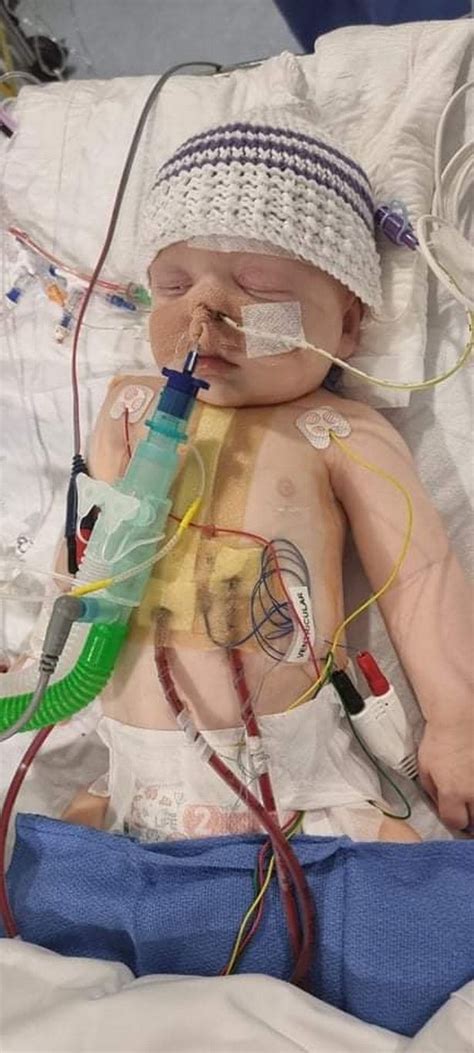 Scots Dads Devastating Moment He Asked Doctors Will My Baby Survive