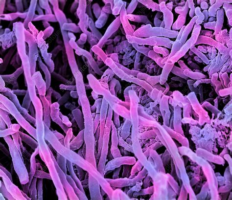 Streptomyces Coelicoflavus Bacteria Sem Stock Image F0124038