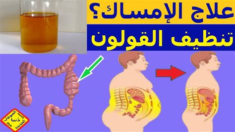 The Strongest And Fastest Effective Treatment For Chronic Constipation And How To Get Rid Of It