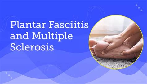 Plantar Fasciitis And Multiple Sclerosis Understanding Foot Pain
