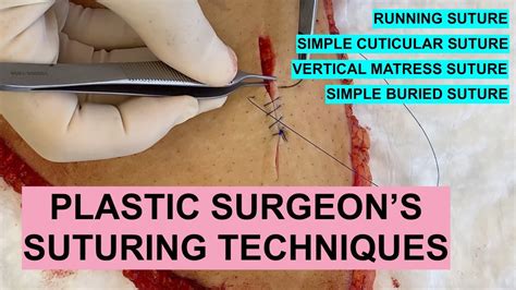 Plastic Surgeon S SUTURE TECHNIQUES Running Simple Cuticular