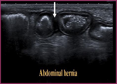 Ultrasound Longitudinal Scan Of Abdominal Hernia In A Dog Showed
