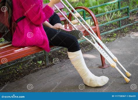 Broken Leg And Crutches And Support Royalty Free Stock Photo