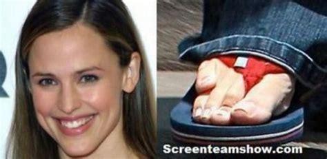 Celebrities And Their Physical Defects Gallery Ebaums World