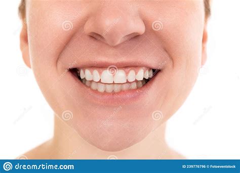 Lower Half Of Woman Face Close Up Smile With Open Mouth And White