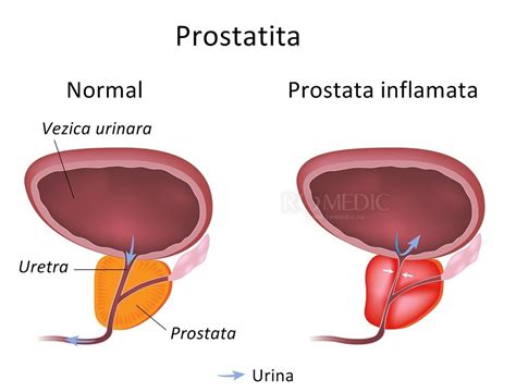 Prostata Anatomie Si Fiziologie