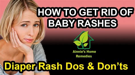 How To Get Rid Of Baby Rashes Home Remedy For Baby Rashes Youtube