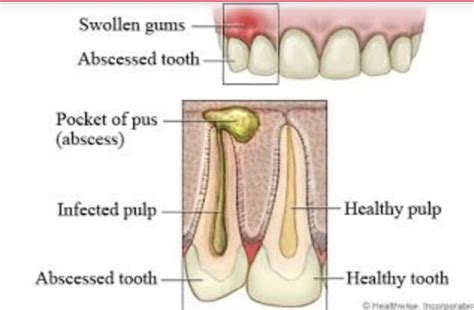 17 Common Dental Problems And Tooth Treatment