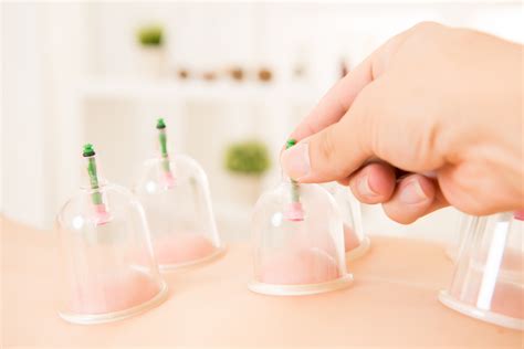 Cupping Therapy The Chiropractic Clinic