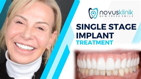 Gülüşünüz en iyisini ve en hızlısını hakediyor ! Your smile deserves