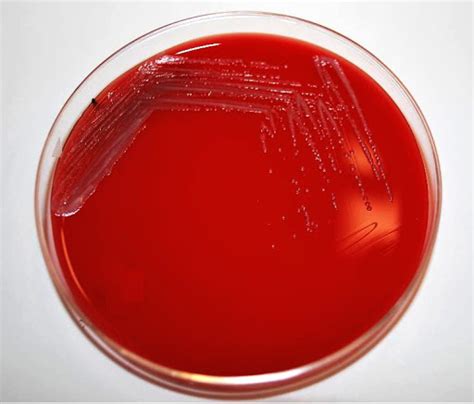 Recipes For Semi Selective Media For Pathogens Growth
