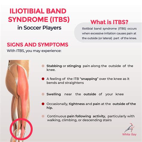 Iliotibial Band Syndrome ITBS Causes Symptoms Treatment
