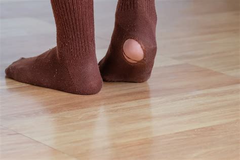 Holes In Socks 10 Reasons And How To Prevent