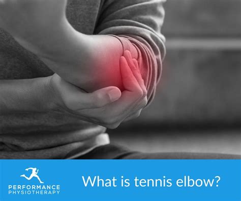 What Is Tennis Elbow Physiotherapy Jersey