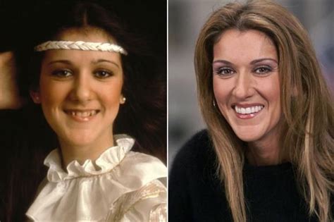 El antes y el después de la estética dental laimportanciadelasonrisa clinicadiamond