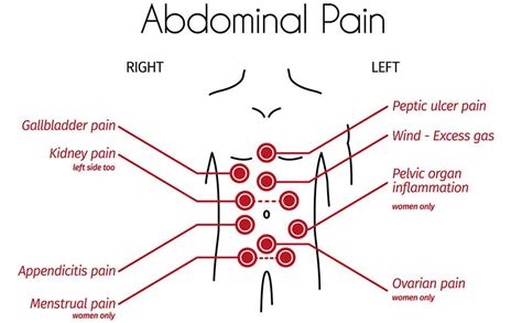Abdominal Pain Location Chart