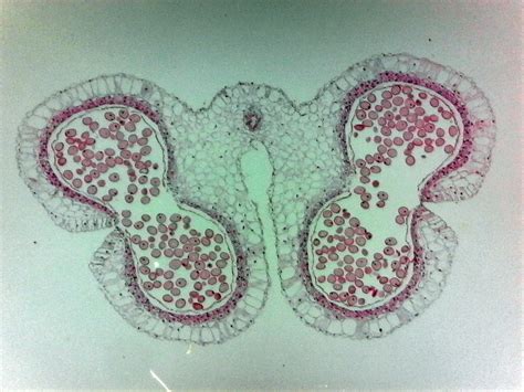 Lily Ovary Cross Section Labeled