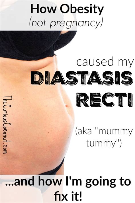 How To Prevent Diastasis Recti Pregnancy Diastasis Recti Exercises Hot Sex Picture