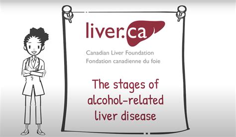 The Different Stages Of Alcohol Related Liver Disease Canadian Liver