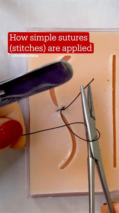 How Simple Sutures Stitches Are Applied Medical School Essentials