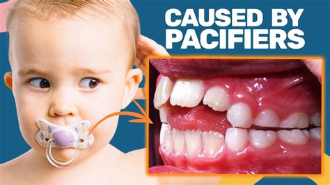 The Dangers Of Pacifier Use And How To Avoid Them Youtube
