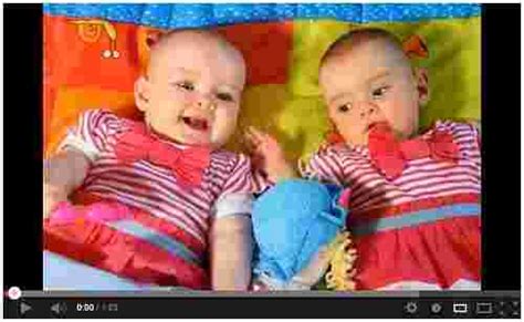 miracle twins born 87 days apart in ireland