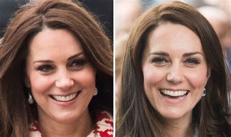 Kate Middleton News Duchess Of Cambridge Denies Using Botox Injection