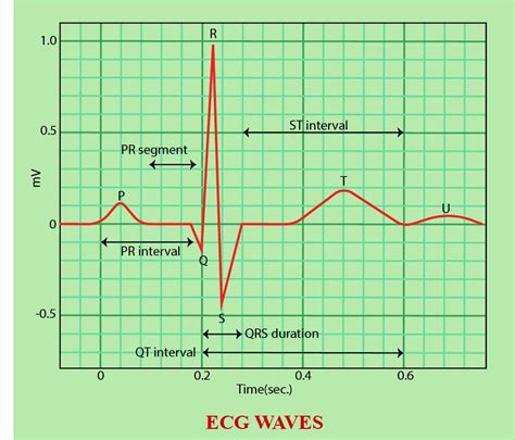 Ecg Wave Diagram