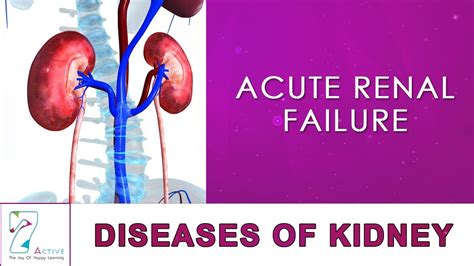 Clinical manifestations, diagnostic assessment, and etiology of heart failure in elderly. ACUTE RENAL FAILURE - YouTube