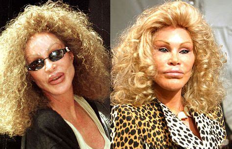 Best And Worst Celebrity Plastic Surgery Celebrity Plastic Surgery