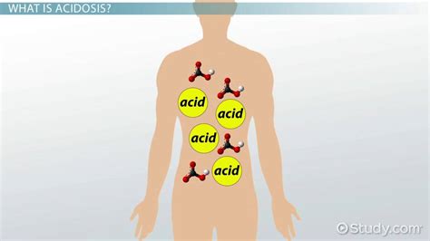 Acidosis Vs Acidemia Lesson
