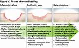 Holistic Wound Healing Images