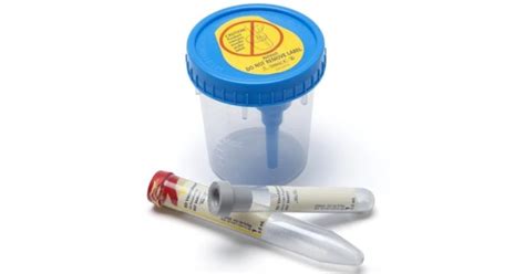 Buy Bd Vacutainer Urine Collection System Get Price For Lab Equipment