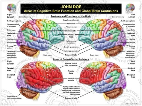 Flash brain anatomy offers lots of key features that the power users are usually interested in this area is approximately coextensive with area 41 in brodmann's cytoarchitectonic map of the human. Areas of Cognitive Brain Function and Global Brain Contusions