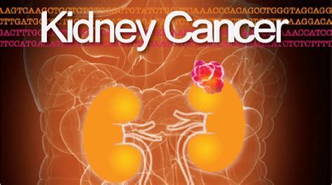 Kidney Cancer Journal Volume 4 Issue 3 Grand Rounds In Urology